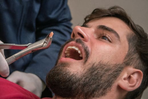 closeup of a young man having a tooth pulled