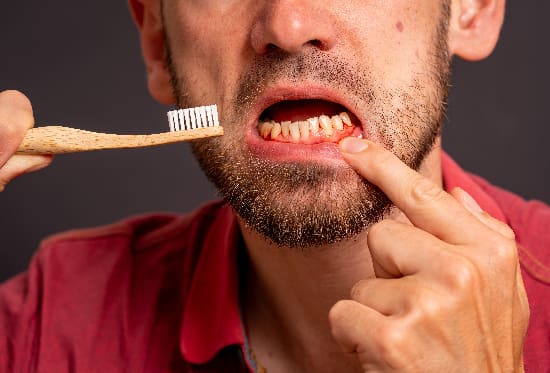 Man brushing teeth suffers from inflamed, bleeding gums as a symptom of periodontitis, poor oral hygiene and dental car
